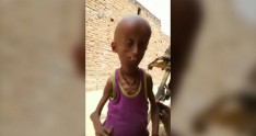 Bu oğlan 160 yaşlı qocanın bədənində yaşayır