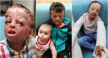 CANİLƏR: Uşaqların üzünü bu hala saldılar