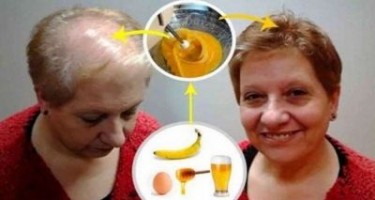 Bu reseptlə saçlarınız tökülməyəcək 