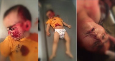 Bu görüntülər az öncə gəldi (18+)