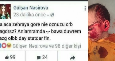 Azərbaycanlı qızdan Zəhra haqda çirkin paylaşım