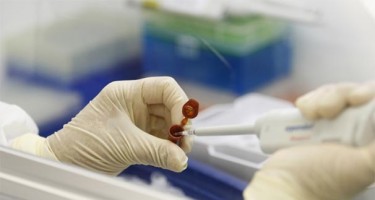 Dəhşətli virus yayıldı