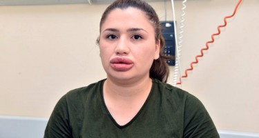 Qadınları tanınmaz hala salan "həkim" həbsxanadan qaçıb