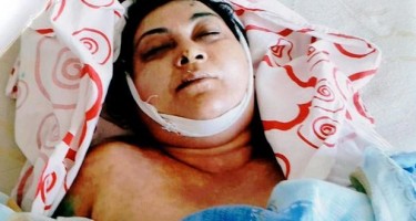 Bu qadın yol qəzasında ölüb