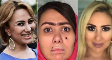 Təranə Səmədovanın dəyişimi