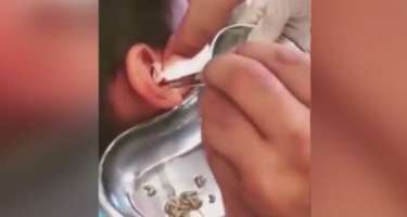 ​Qulaq ağrısına görə həkimə getdi