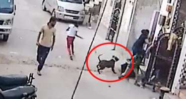 DƏHŞƏT! Vəhşi Pitbul uşağa hücum etdi