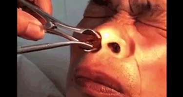 Burnundan çıxanı görənlər 