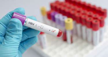 Ölkədə hepatitlə bağlı STATİSTİKA 
