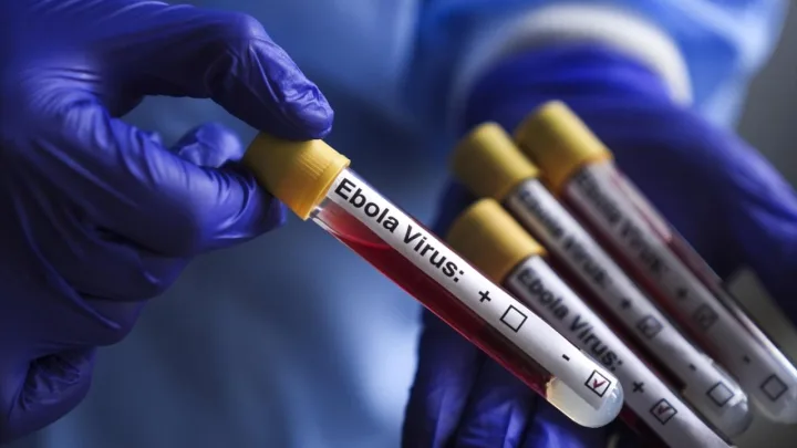 Ebola ilə bağlı sevindirici xəbər: Peyvənd tapıldı