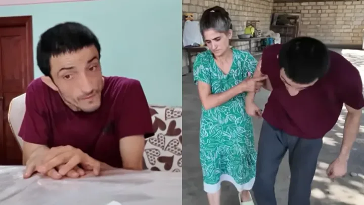 Ucar sakininə müddətsiz I dərəcə əlillik təyin olundu - 