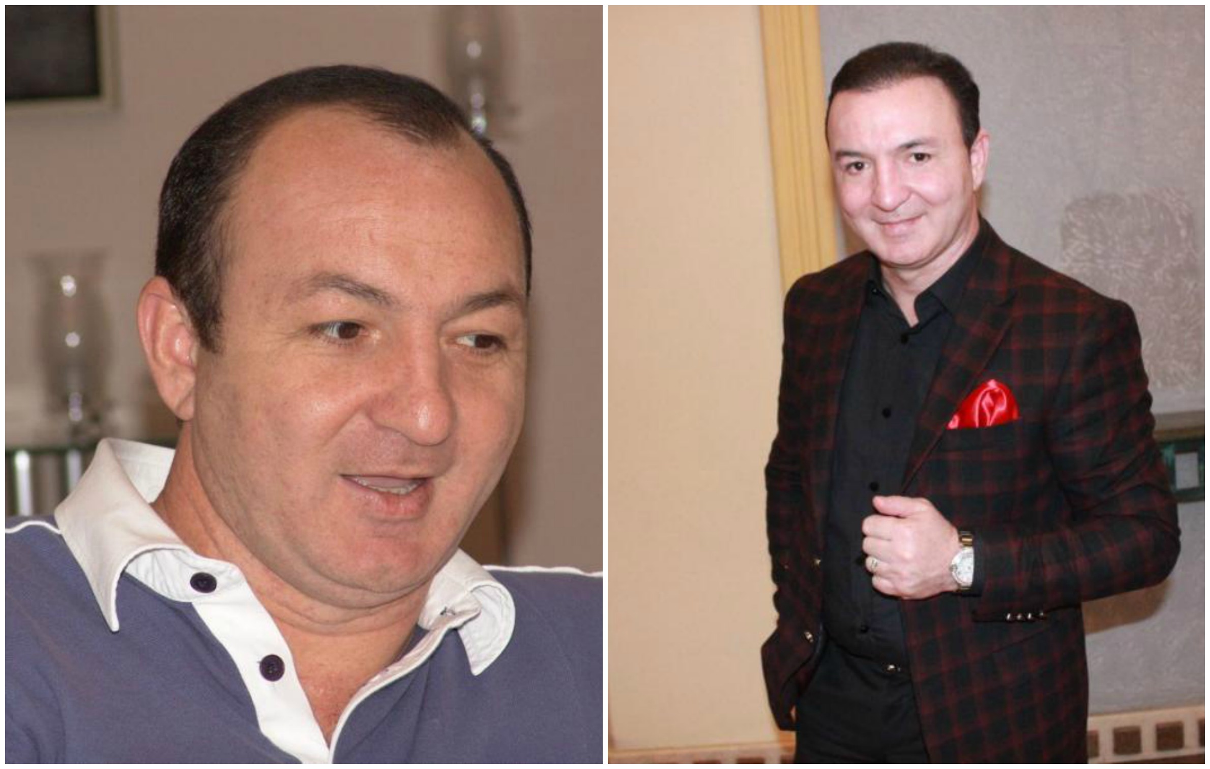 Azərbaycanda keçəllikdən əziyyət çəkən məşhurlar