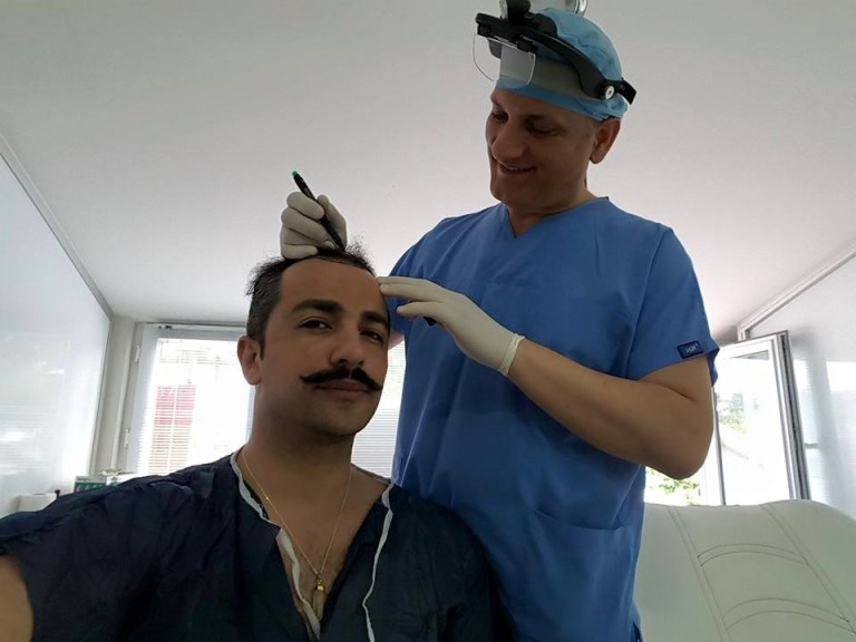 Azərbaycanda keçəllikdən əziyyət çəkən məşhurlar