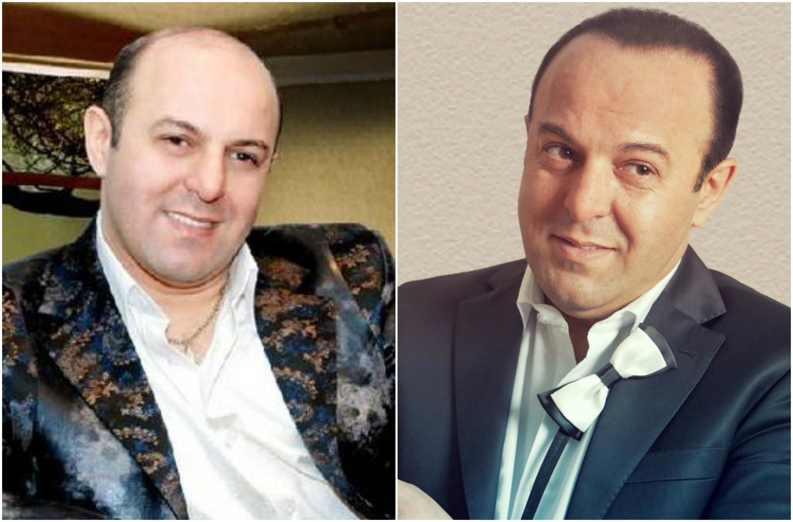 Azərbaycanda keçəllikdən əziyyət çəkən məşhurlar