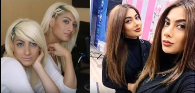 Azərbaycanlı məşhurlar əməliyyatdan sonra...