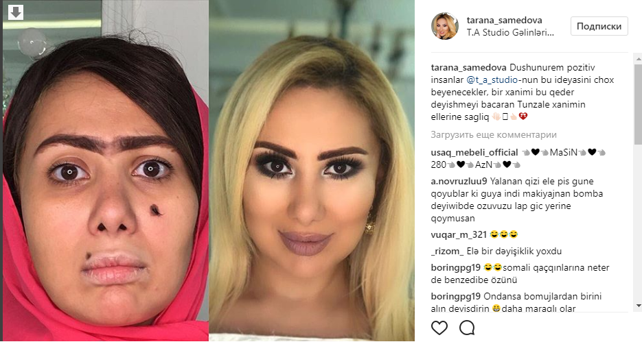 Təranə Səmədovanın dəyişimi
