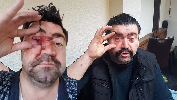 Bu adamın başına belə bir hadisə gəldi