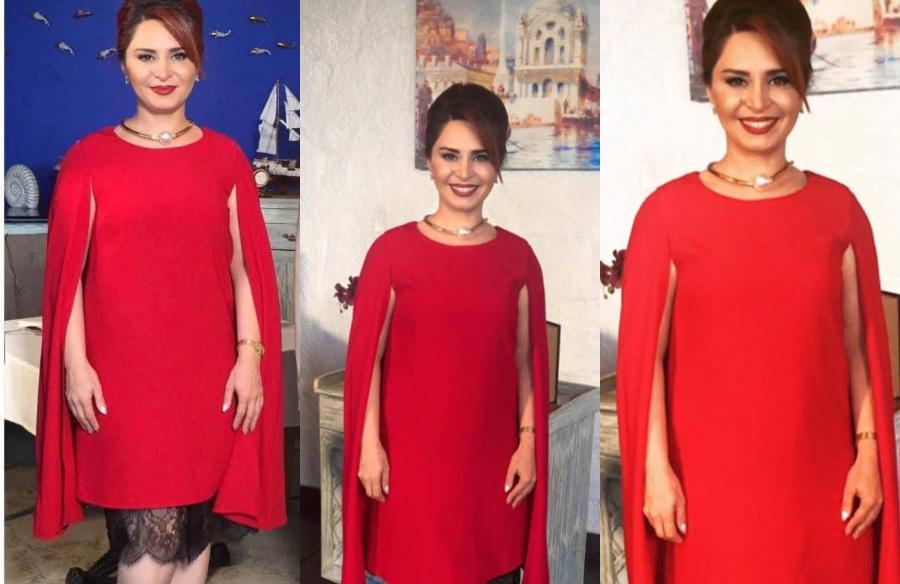 Azərbaycanlı aparıcı Melani Trampla bənzər geyimdə -